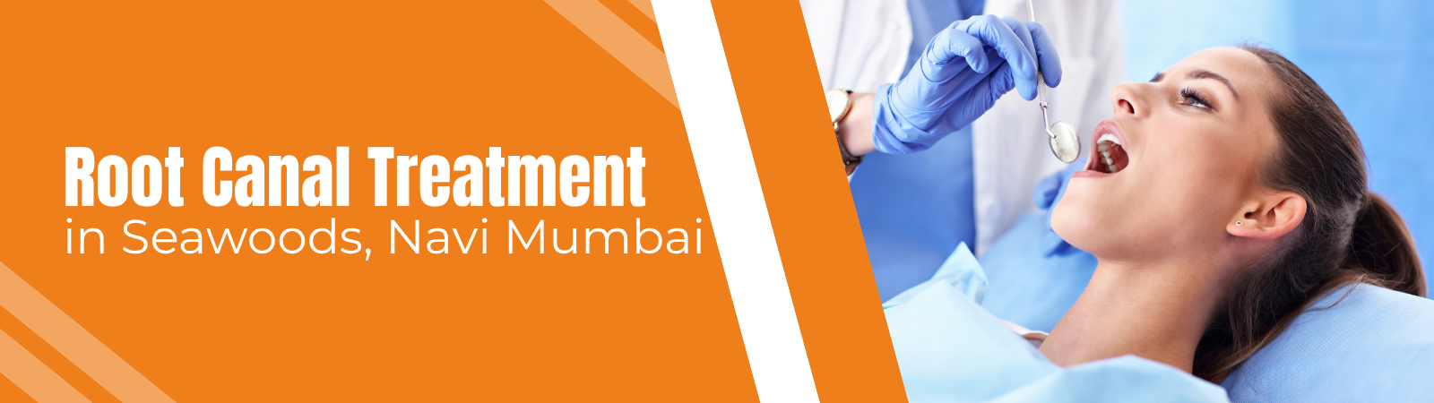 Root canal treatment at Age Concepts dental clinic in Seawoods, Navi Mumbai