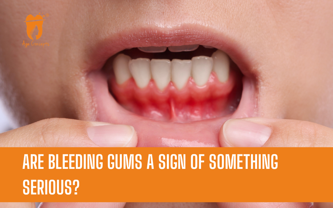 Close-up of a mouth with red, bleeding gums; orange banner reads 'Are bleeding gums a sign of something serious?'