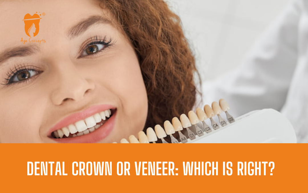 Dental Crown or Veneer Which Is Right