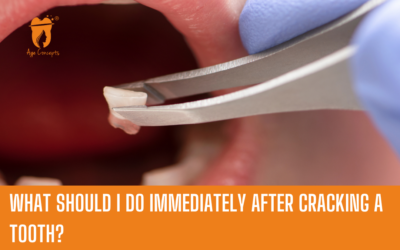 What should I do immediately after cracking a tooth?