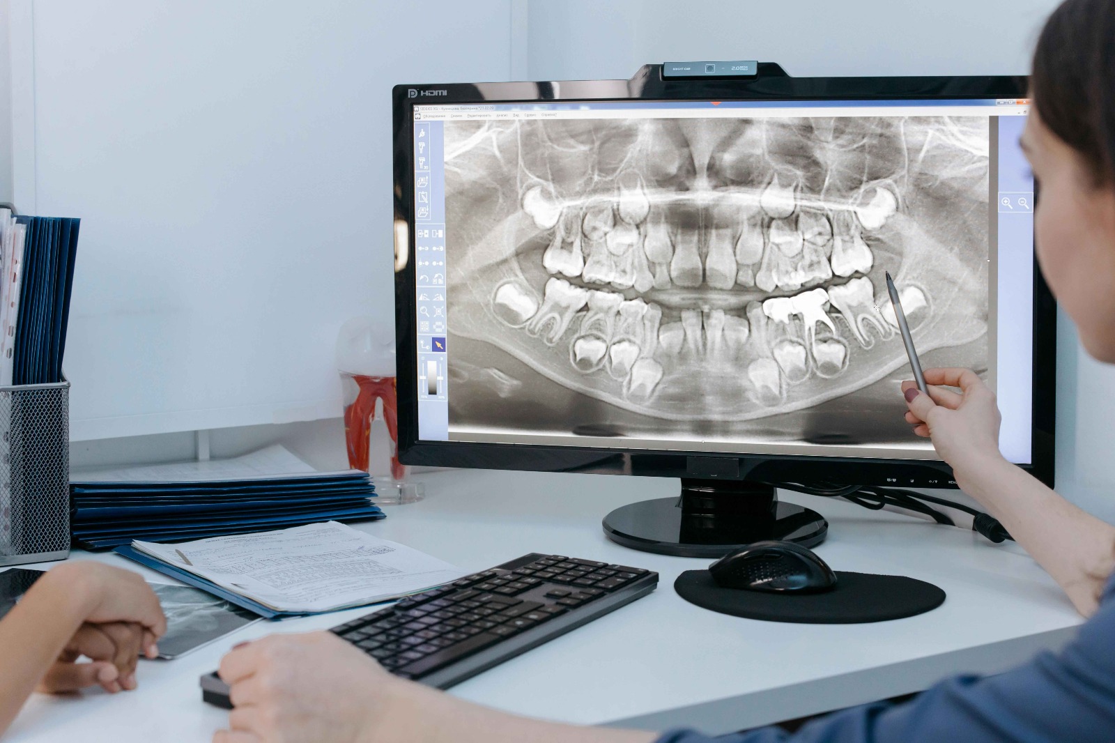 Dental professional analyzes a full-mouth panoramic dental X-ray on a computer monitor, pointing at the image with a stylus.