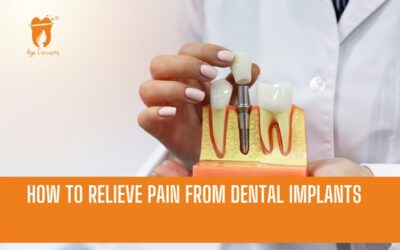 How to Relieve Pain from Dental Implants: A Complete Recovery Guide