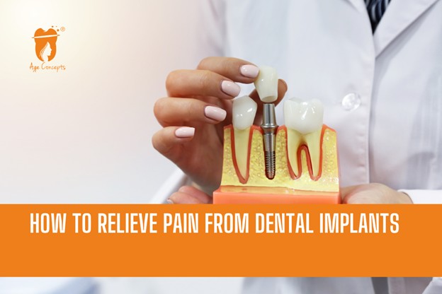 Dental implant model with a clinician showing a screw implant; orange banner reads 'How to relieve pain from dental implants' (informational image).