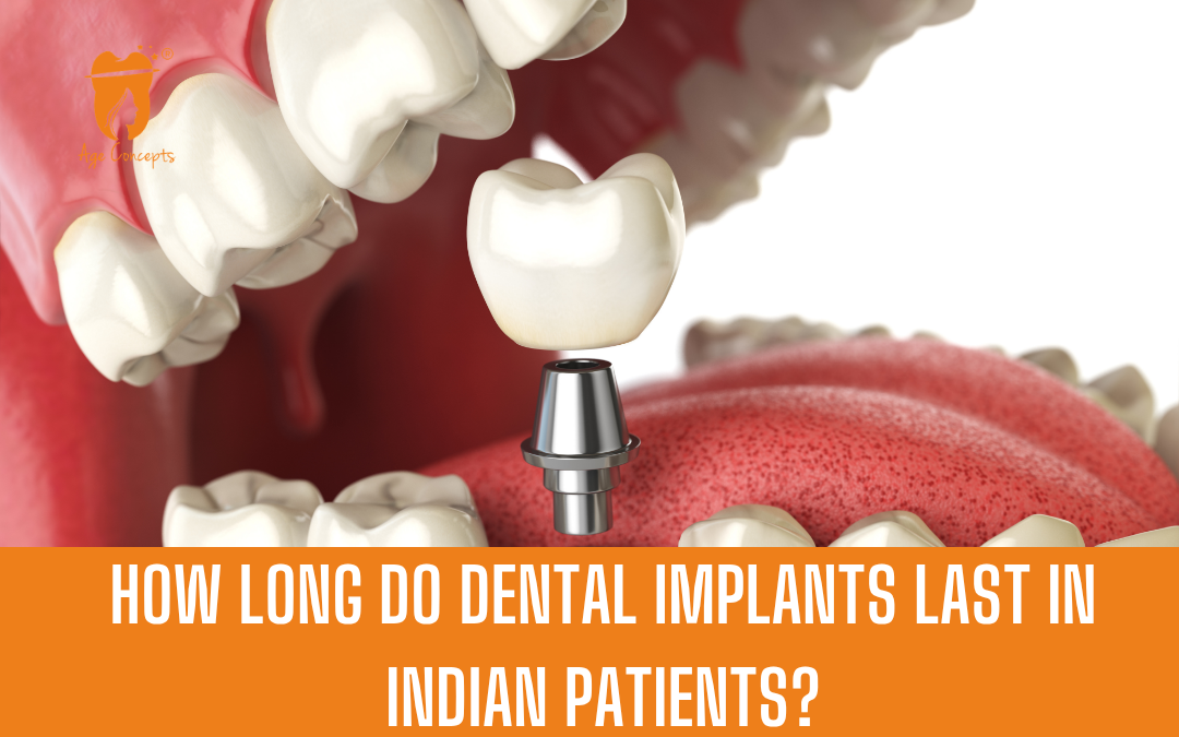How long do dental implants last in Indian patients