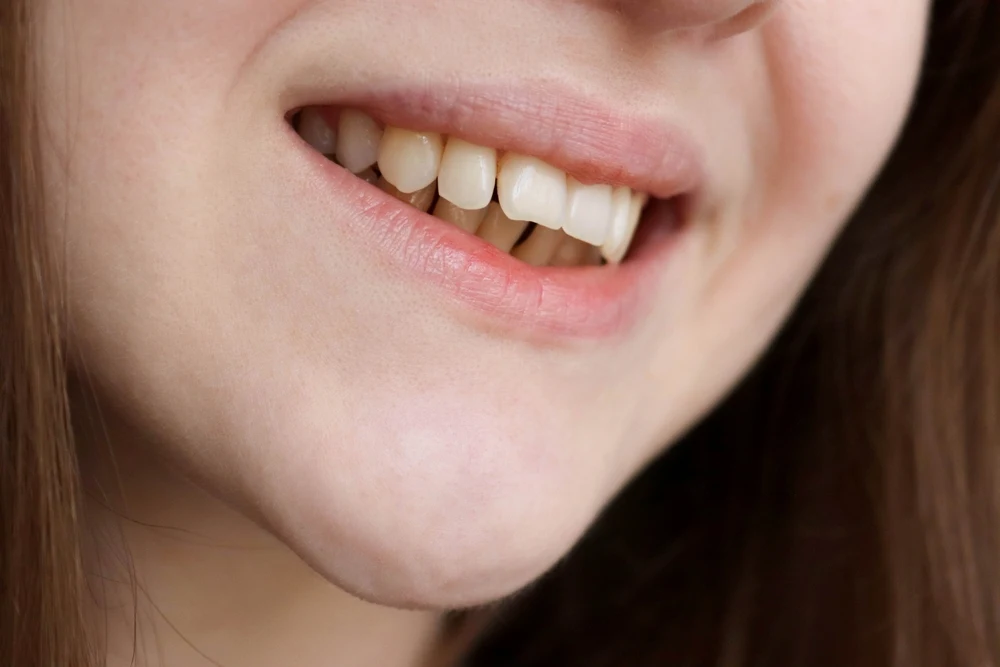 Close-up of a person's mouth in a smile, showing front teeth and pink lips.