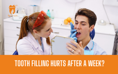 Tooth Filling Hurts After a Week? Here’s What’s Actually Going On